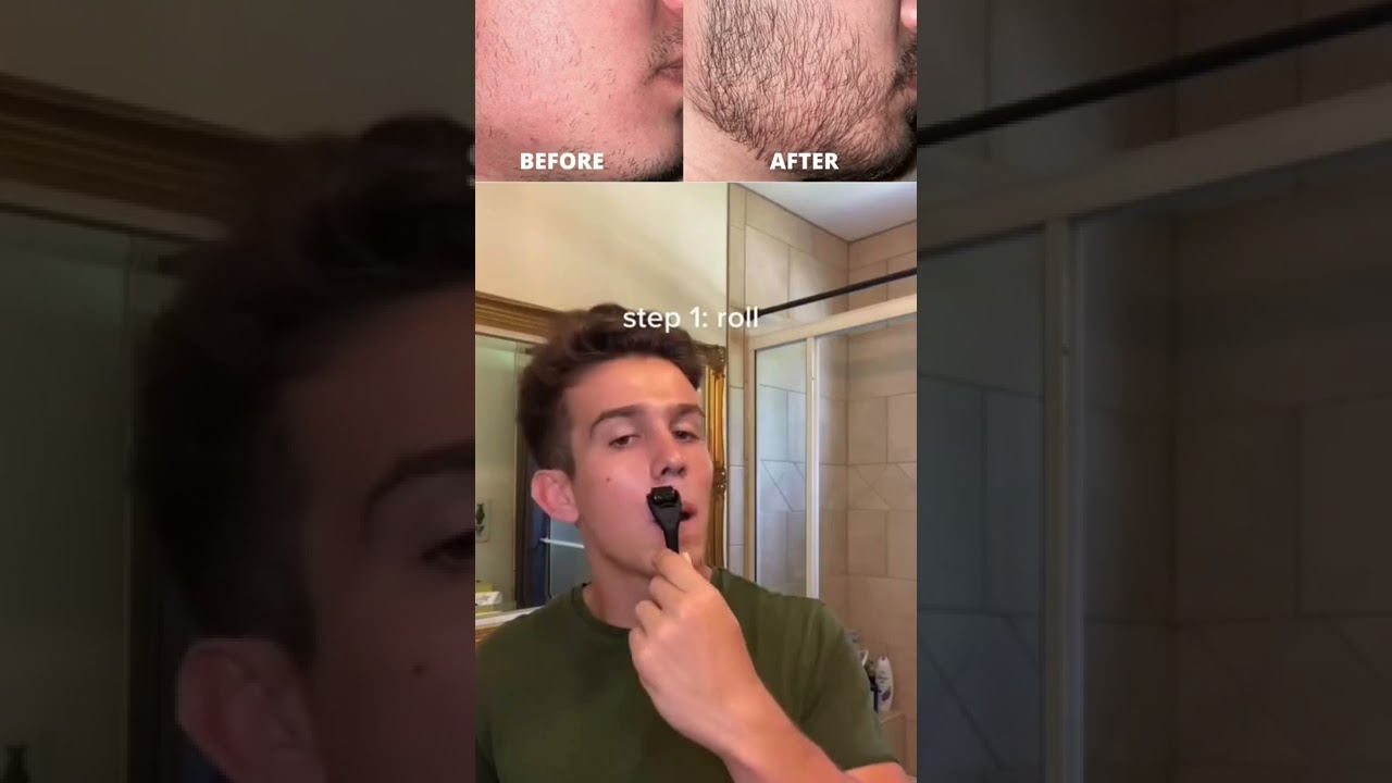 I Tried The Beard Growth Kit And Got Crazy Results #shorts