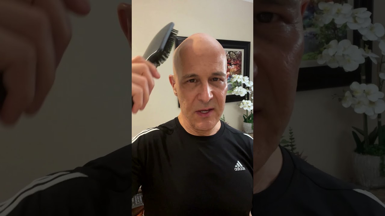 Simple Remedies For Balding & Hair Loss | Dr. Mandell